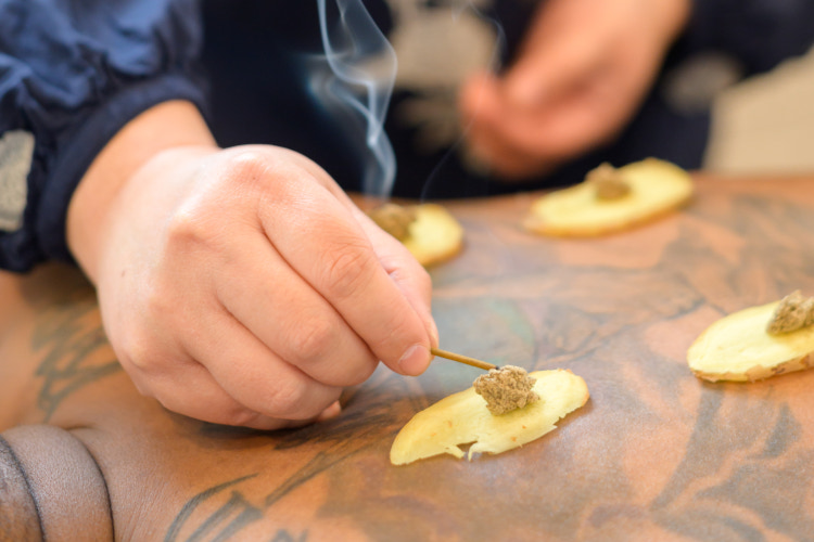 Warm therapeutic environment used for moxibustion treatments